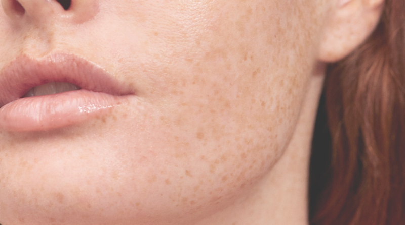 Zo kom jij van jouw lippenbalsem (labello) verslaving af!