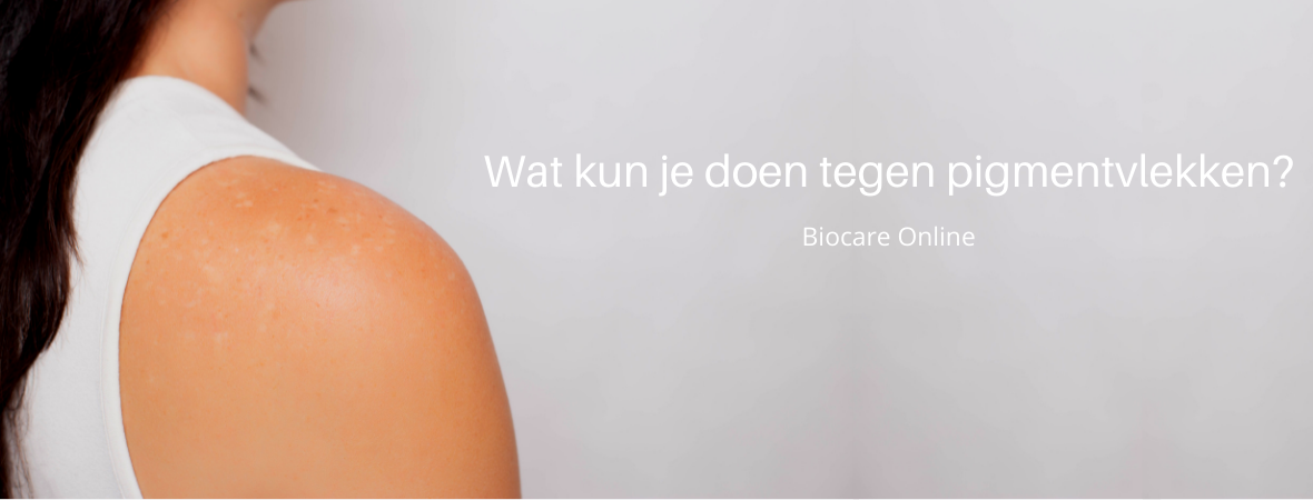 Wat kun je doen tegen pigmentvlekken?